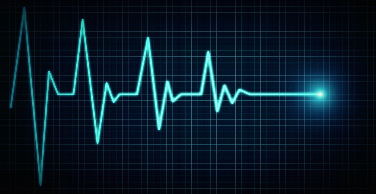 heart waves on monitor